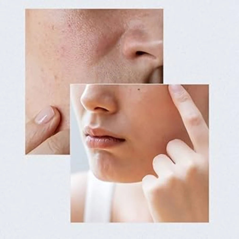 ANUA - BIRCH MOOISTURE BOOSTING SERUM