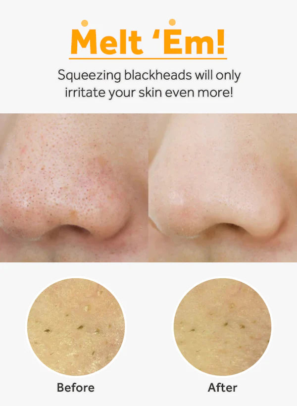 MANYO - PURE CLEANSING OIL