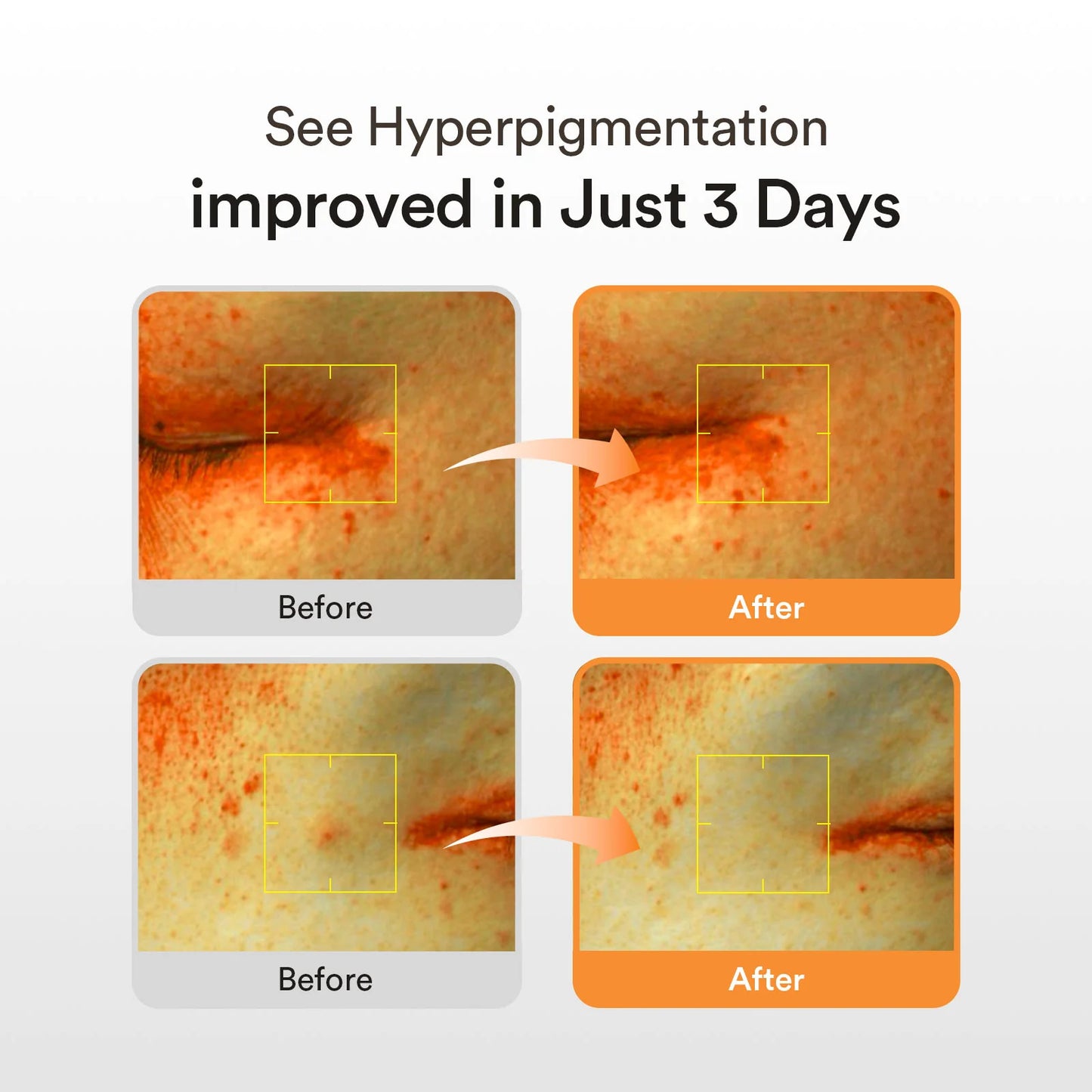 ABIB - GLUTATHIOSOME DARK SPOT SERUM VITA DROP