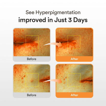 ABIB - GLUTATHIOSOME DARK SPOT SERUM VITA DROP