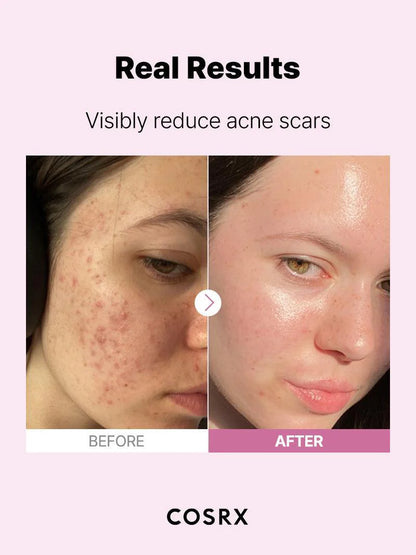 COSRX - THE NIACINAMIDE 15